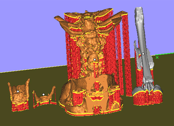 medical 3d model1